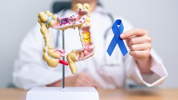 Mengenal Early-Onset Cancer: Tren Peningkatan Kasus Kanker pada Usia Muda yang Perlu Diwaspadai