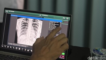 Skrining Tuberkulosis Massal di Pesantren Jakut: Perkuat Deteksi Dini, Tekan Angka Kasus yang Belum Terjangkau
