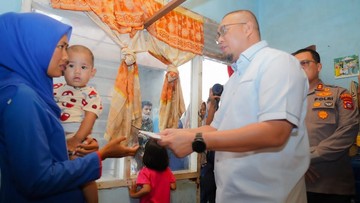 Aksi Kemanusiaan Andre Rosiade Berikan Bantuan Medis untuk Balita Penderita Tumor di Padang